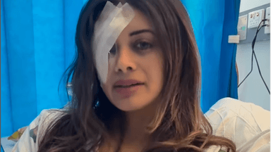 NSW Police to review "scuffle" that injured Greens candidate